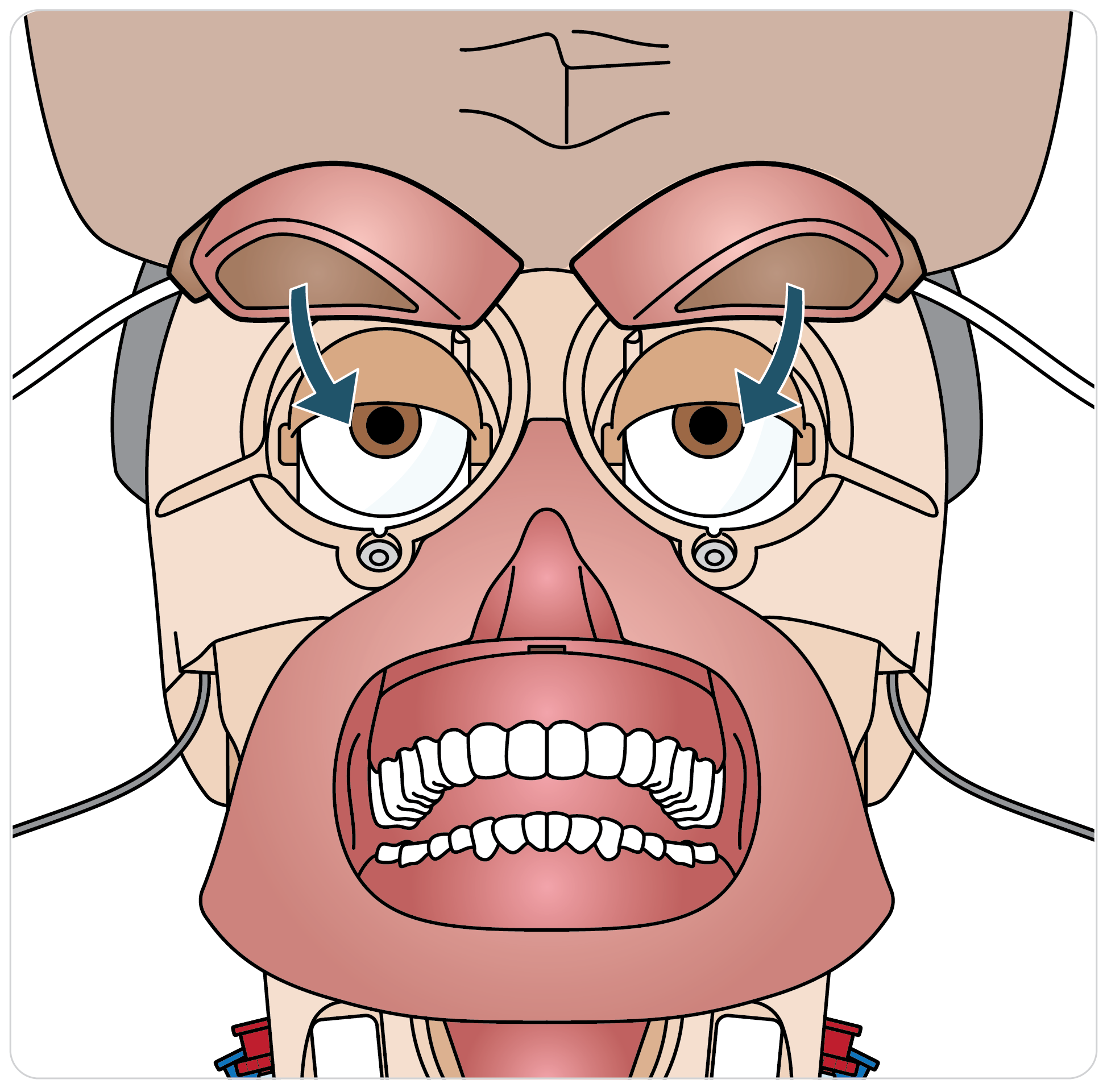 Paligo__Trauma_Head_Neck_Airway_02.png