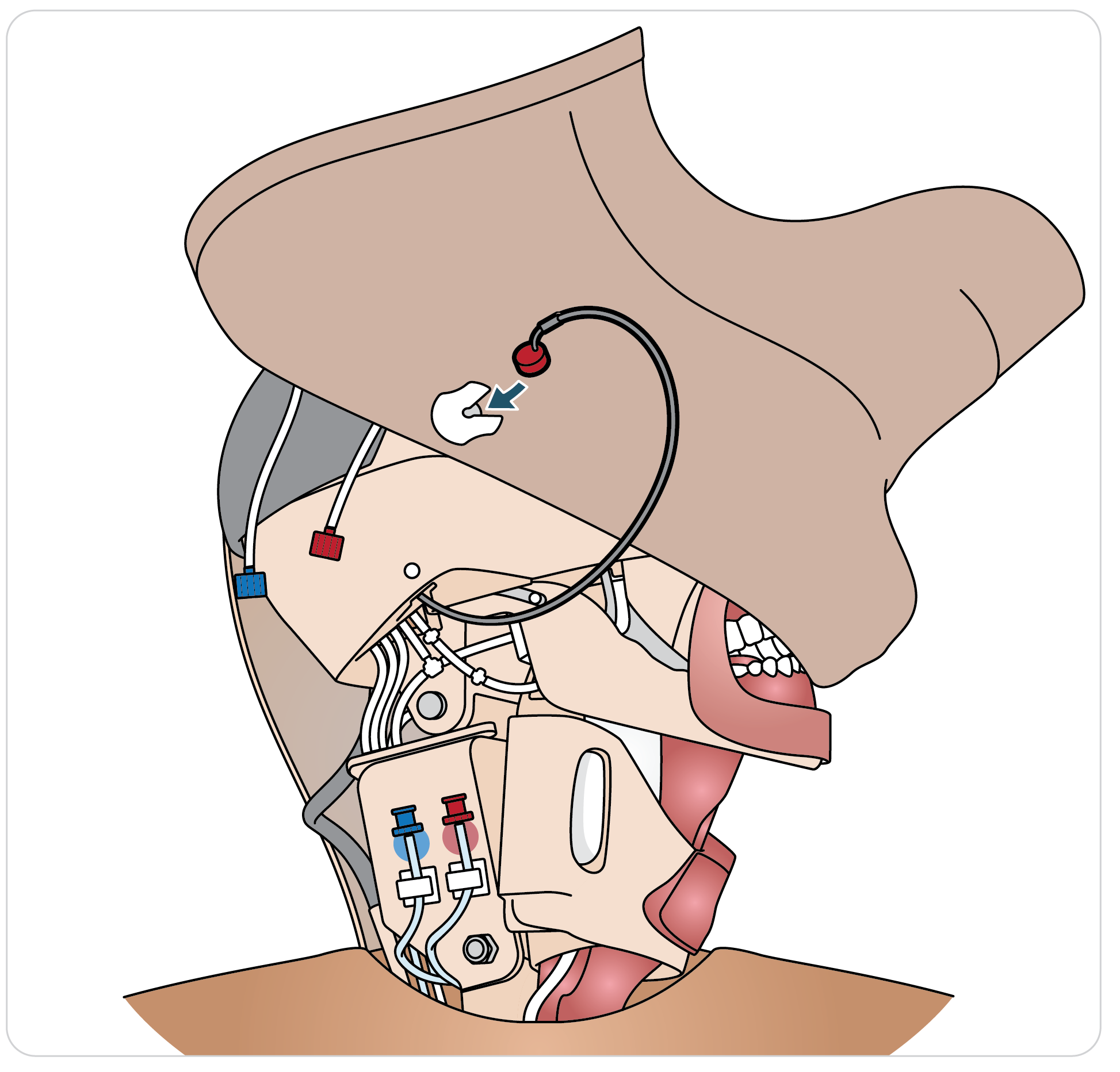 Paligo__Trauma_Head_Neck_Airway_05.png