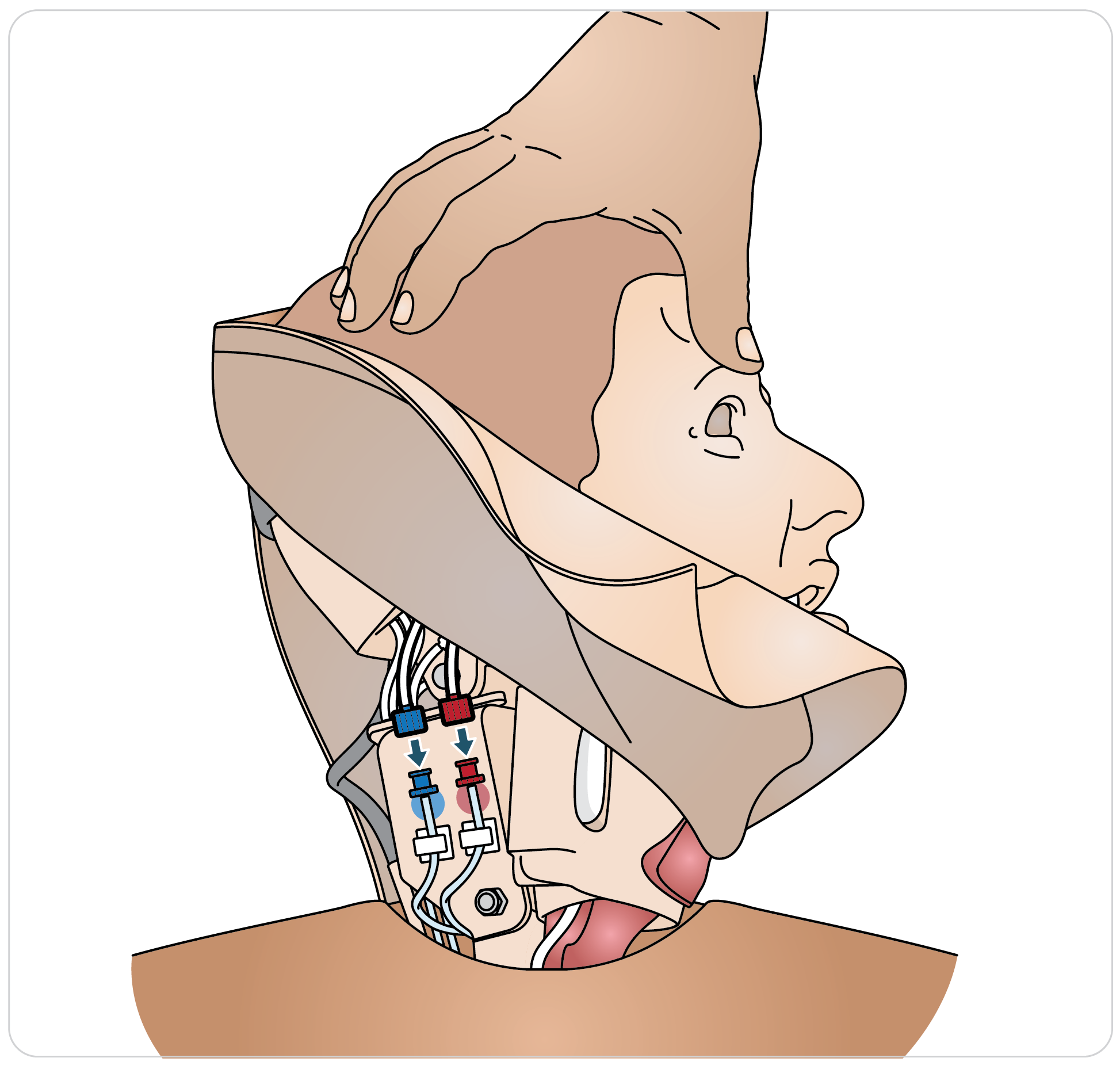 Paligo__Trauma_Head_Neck_Airway_06.png