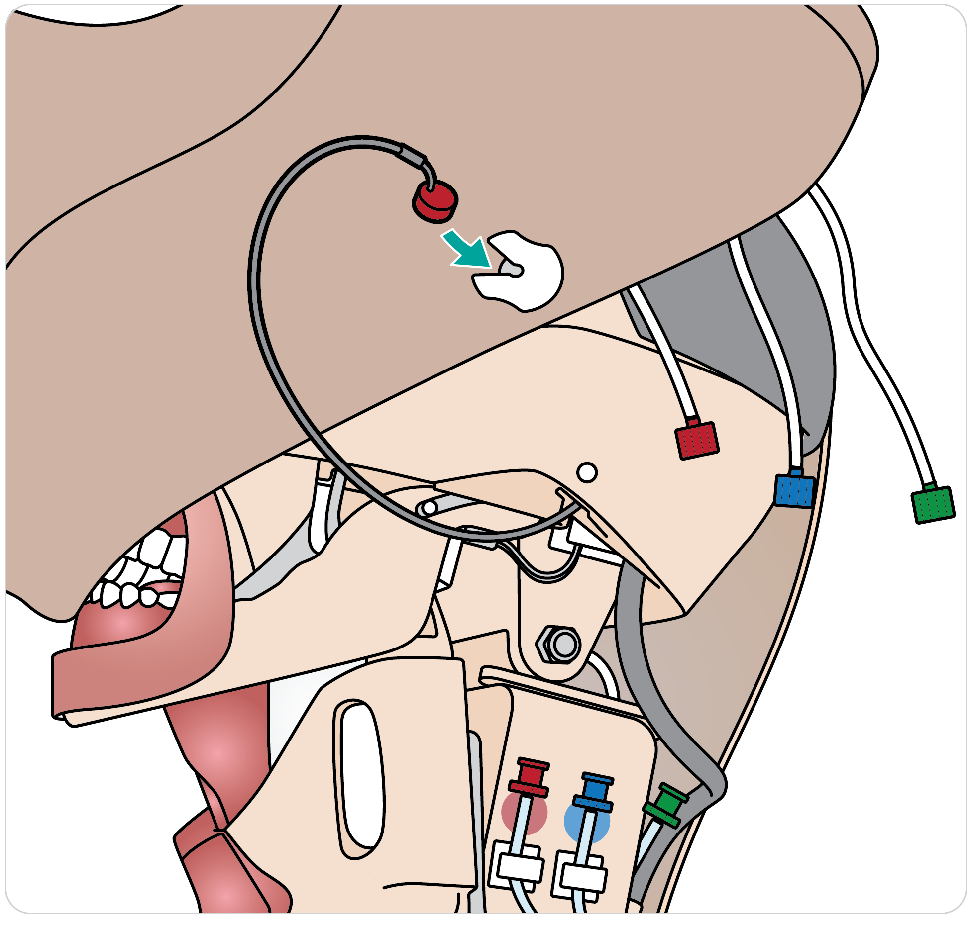 Paligo__Trauma_Head_Neck_Airway_03.png