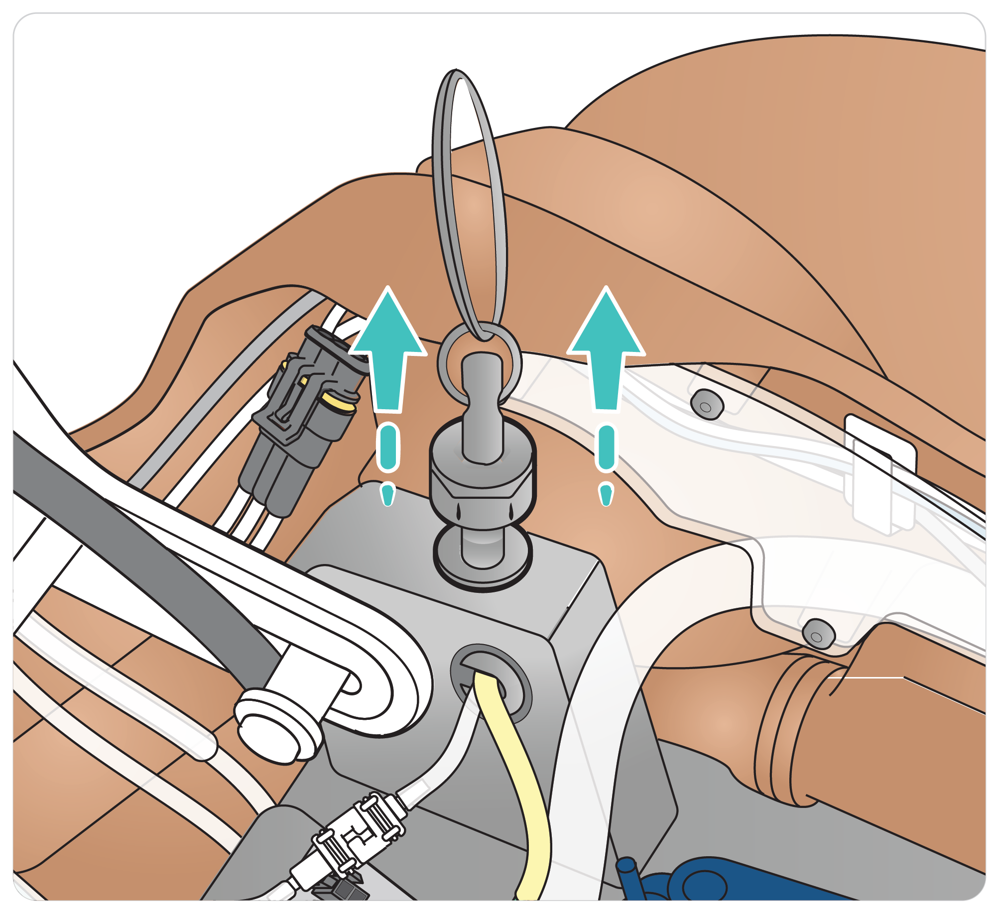 SimMan_Arms_Removing_the_Arm_03.png