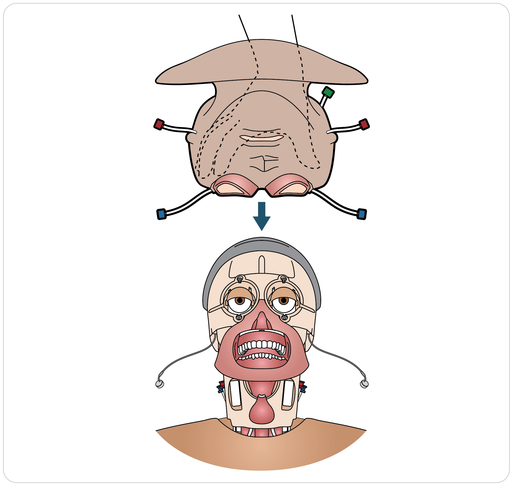 Paligo__Trauma_Head_Neck_Airway_01.png