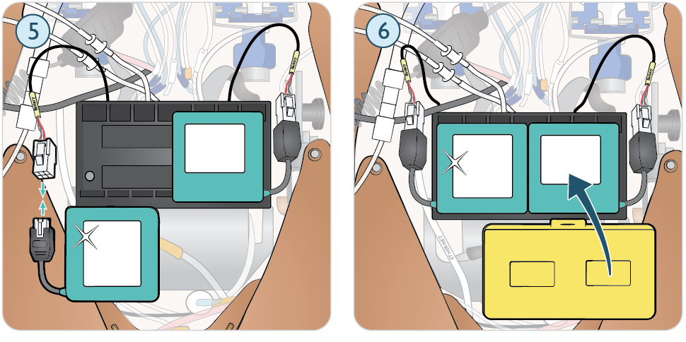 Paligo_Trauma_Setup_Batteries_02.png