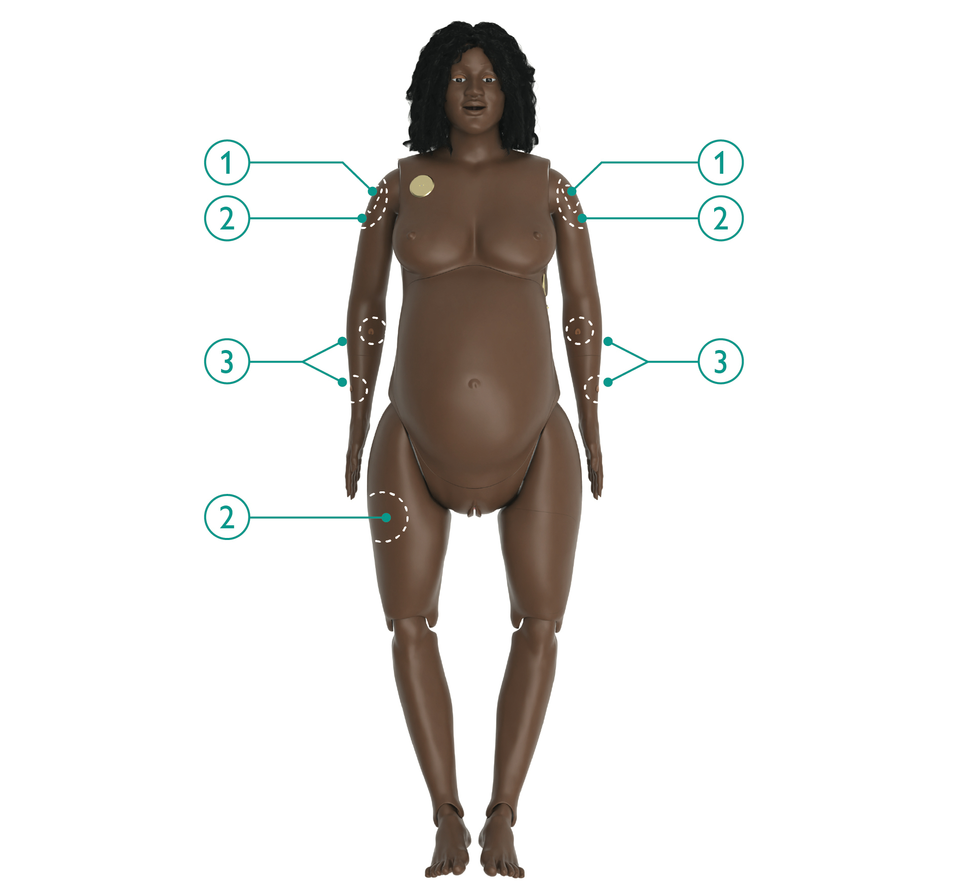 MA_Injection_Sites_Overview.jpg